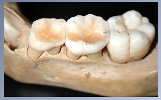 <p><span>Coarse diet:</span><br><span>• Movement of teeth à interproximal and occlusal wear à reduction in arch circumference of >10mm.</span><br><span>• Spaces do not open up between posterior teeth, but molars migrate mesially keeping the contacts tight.</span></p>