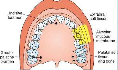 <p>pulps of: first premolar, second premolar, MB root of the mx first molar</p><p>+buccal bone and buccal periodontium over these teeth</p><p></p>