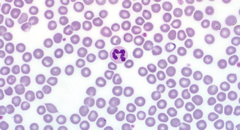 <p>segmented, mature WBC; phagocyte & reacts to inflammation</p>