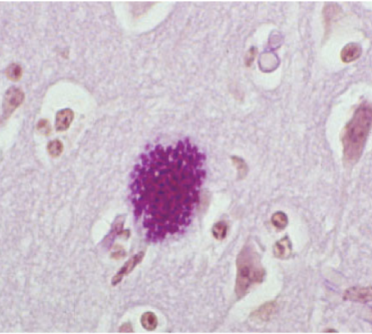term image