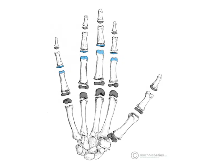<p>Joints between the phalanges.</p>