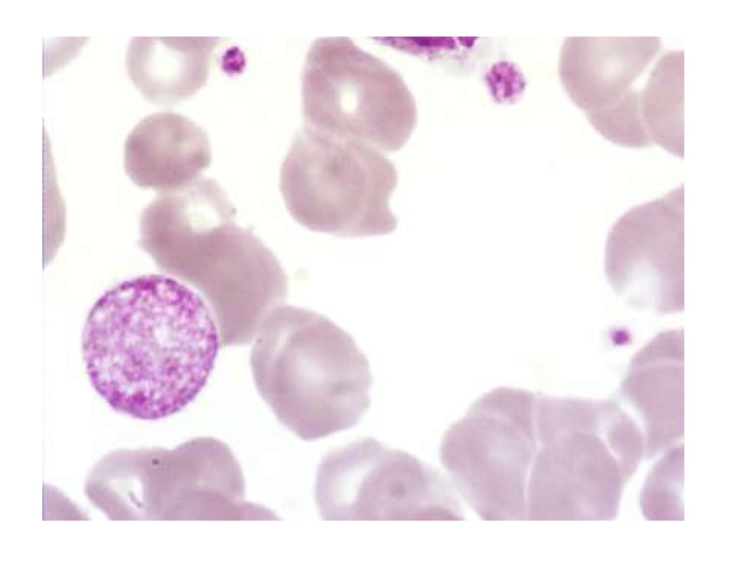 <p>Name this abnormality, and how can we tell?</p>
