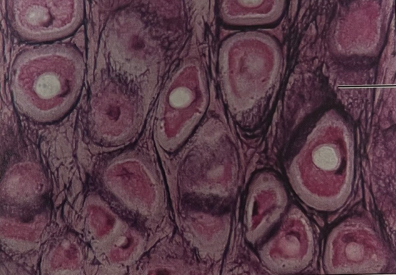 <p>what structure and cartilage is this</p>