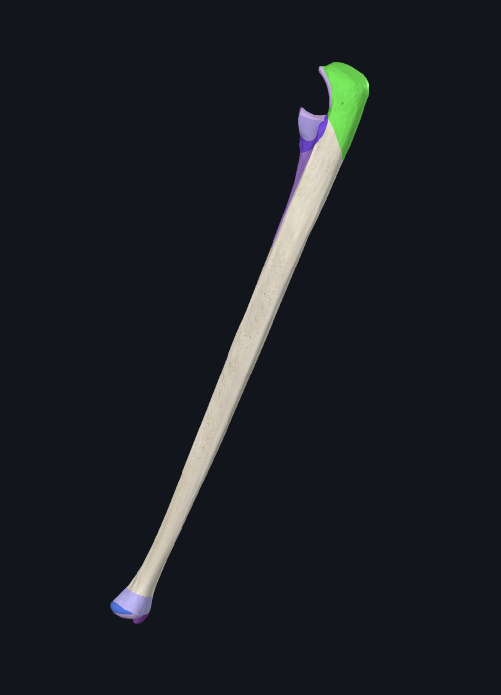 <p>What is highlighted in green?</p>