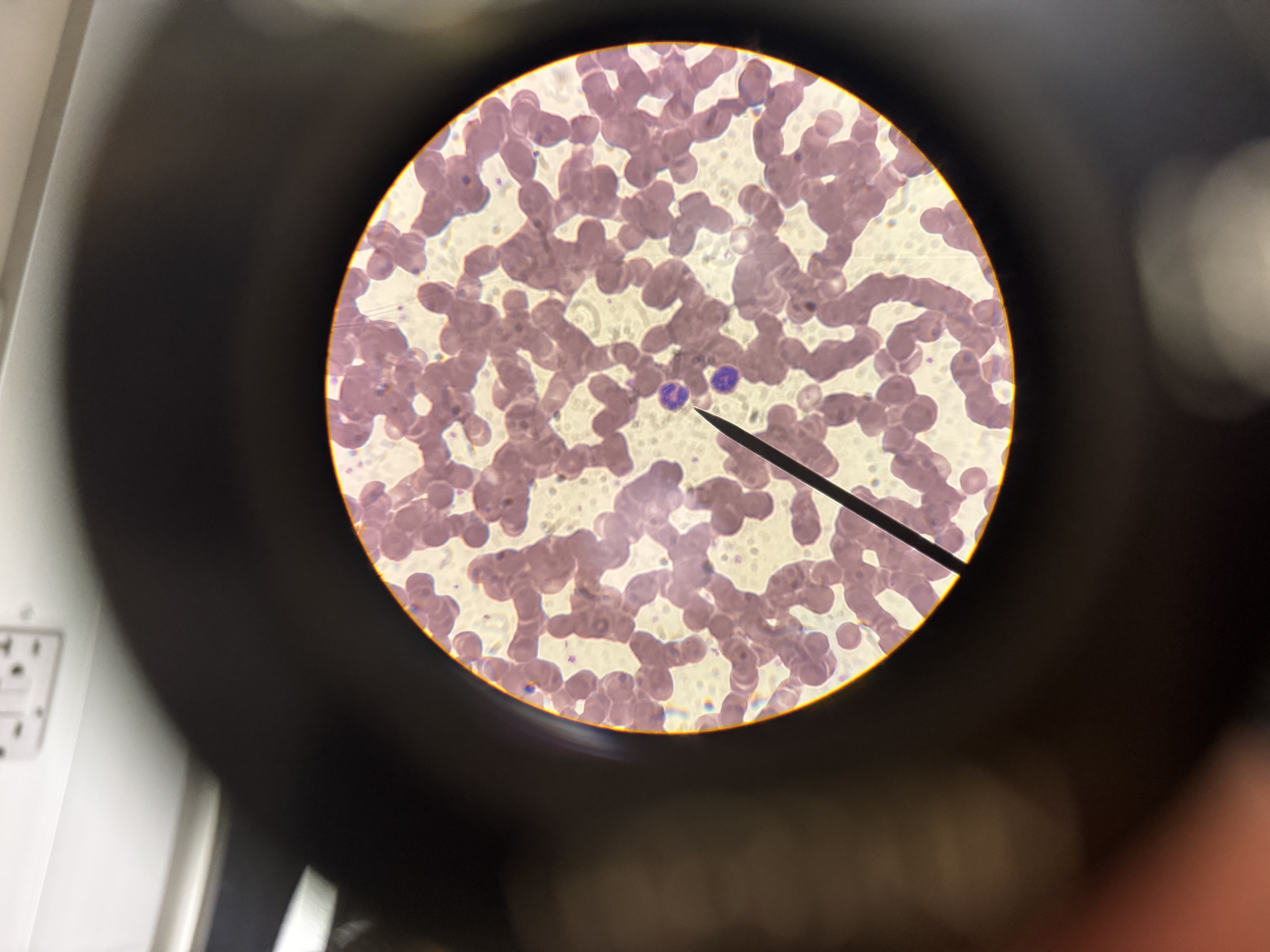 <p>a) Which WBC is this?</p><p>b) Describe the nucleus.</p><p>c) Common or rare?</p><p>d) Function?</p>