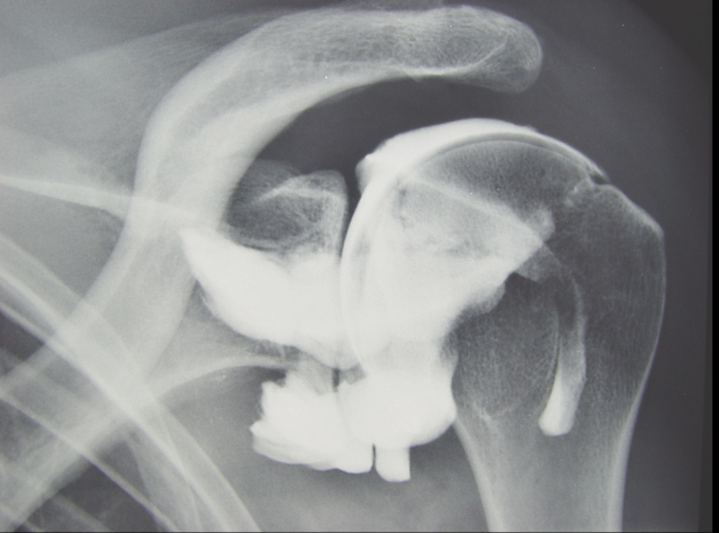 <p><strong>INTRO</strong></p><p>Techniek arthrografie?</p>