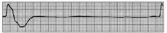<p>Which rhythm is this?</p>