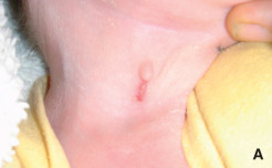 <p>si seno cervical no desaparece </p>
