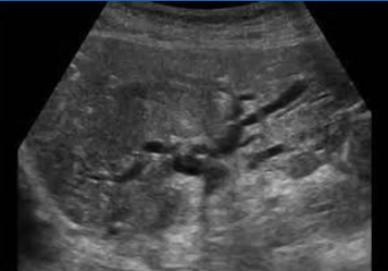 <p>what is shown in this image</p>