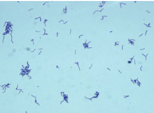 <p>which species of <strong>eubacterium</strong> is best described below:</p><ul><li><p>beading, filaments, branching, similar to <strong>actinomyces</strong> </p><ul><li><p>found in oral cavity; periodontal disease</p></li></ul></li></ul><p></p>