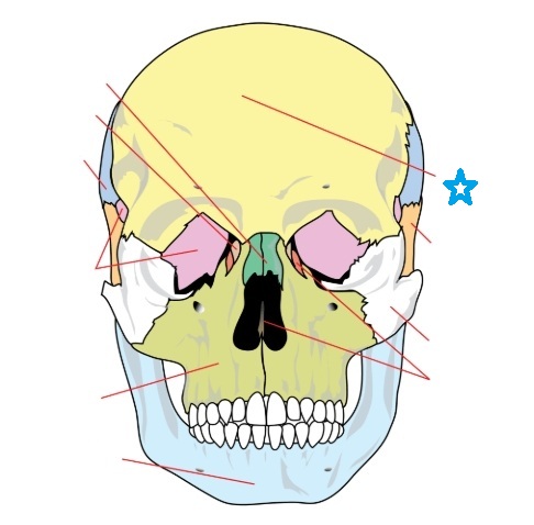 <p>Identify this bone feature labeled by the blue star and define its anatomical purpose.</p>