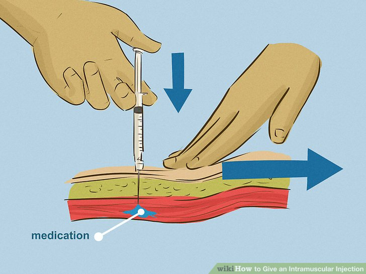 <p>the injection is given at a 90 degree angle into a muscle</p>