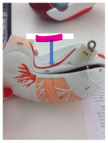 <p>What is the pink arrow?</p>
