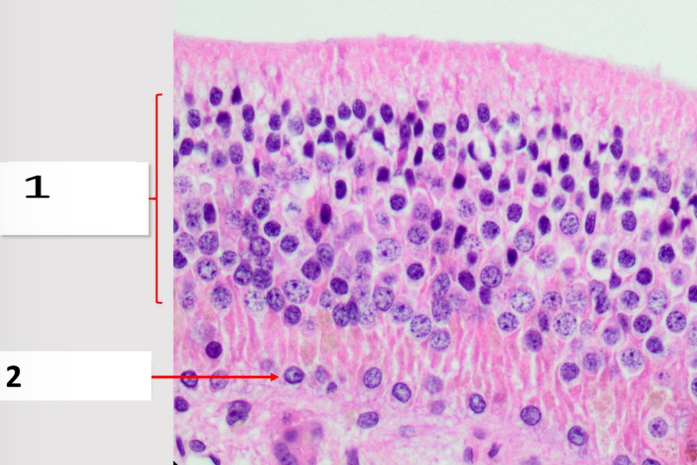 <p>Name the structure indicated by 1.</p>