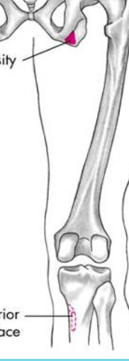 <p>upper anterior surface of medial tibia</p>