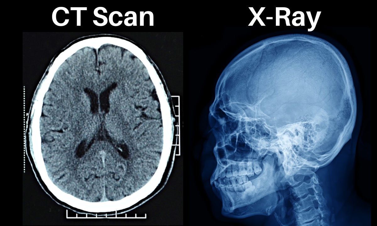 <p><strong>CT scan</strong></p>