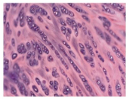 <p>fibers: large collagen fibers</p><p>location: intervertebral discs</p>