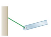 <p>What type of support condition is this?</p>