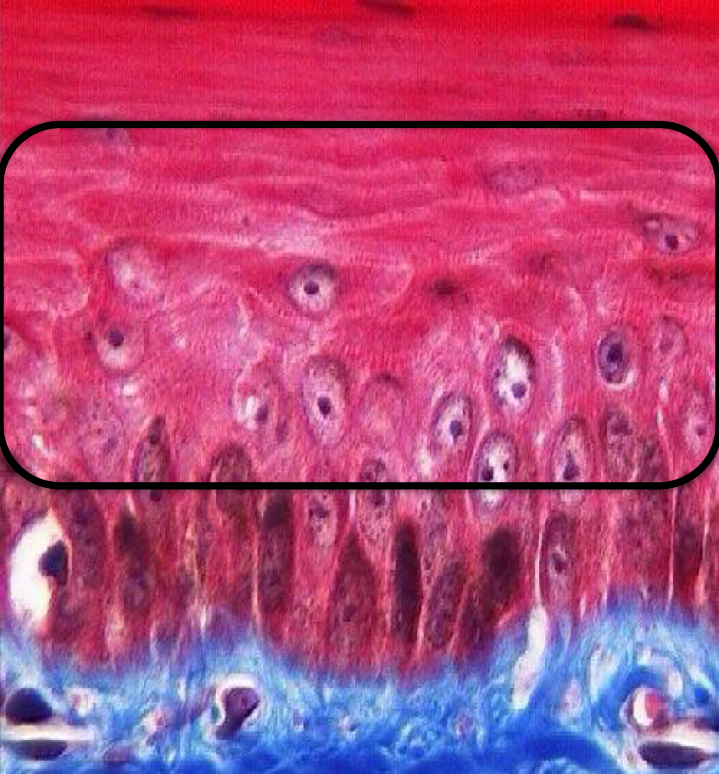 <p>What layer of the epidermis is this?</p>