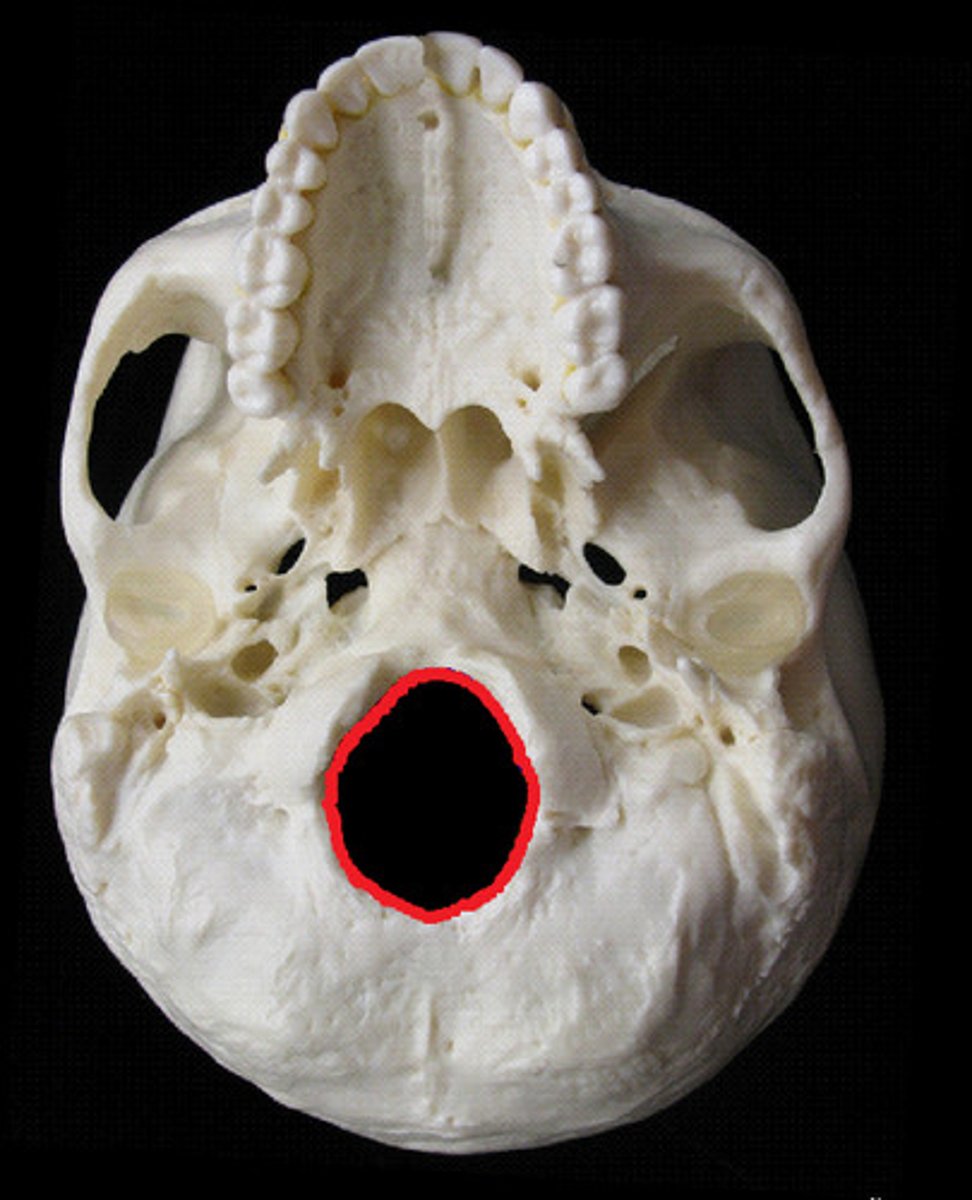 <p>Id opening circled in red</p>