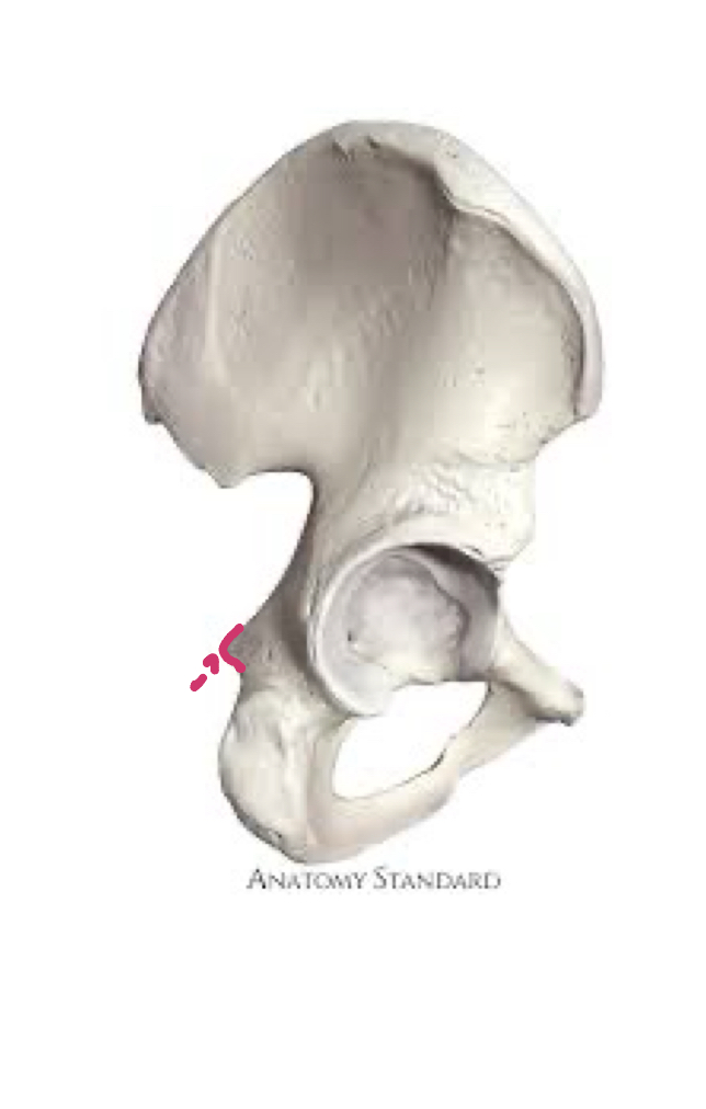 <p>Under GSN, part that sticks out</p>