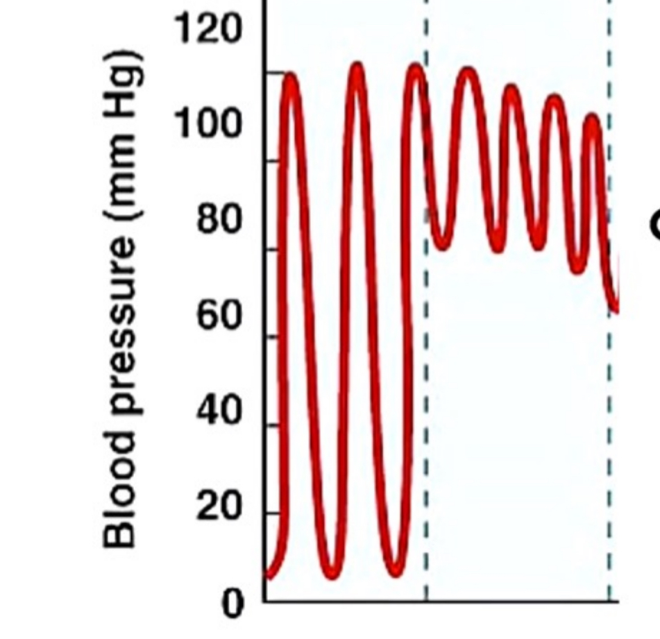 <p>Is the left half “left ventricles” or “arteries”?</p>