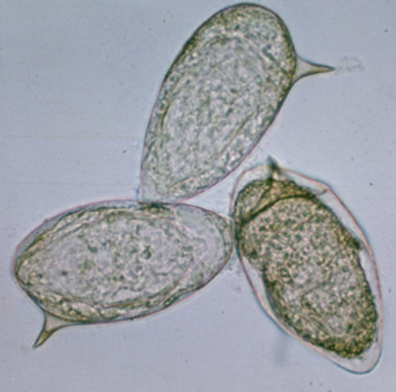 <p>What parasite is this?</p>