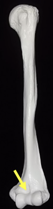 <p>Coronoid fossa (humerus distal end)</p>
