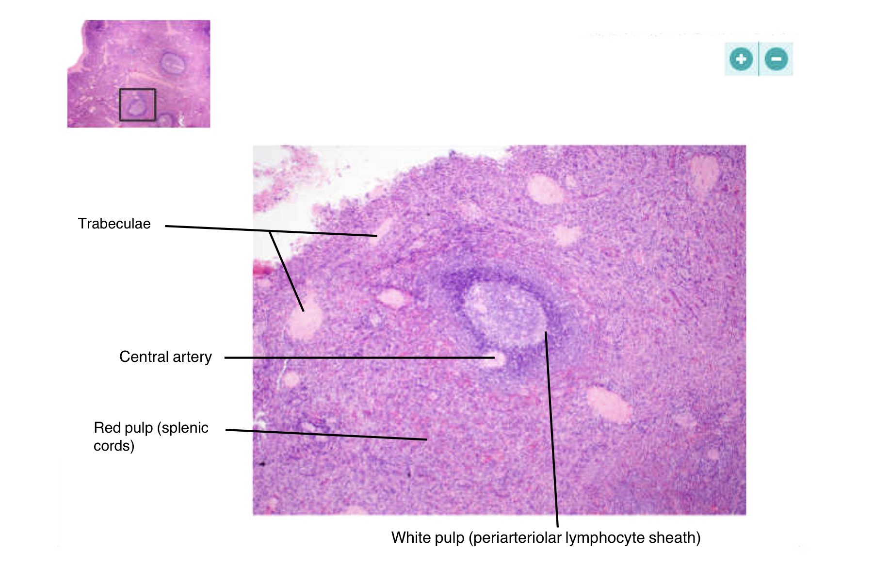 <p>Capsule, Red pulp, white pulp</p>