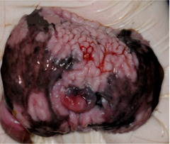 <p>What is this penis abnormality?</p>