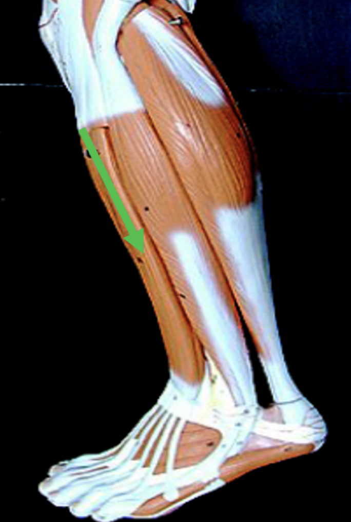 <p>Identify the muscle indicated by the pointer.</p>