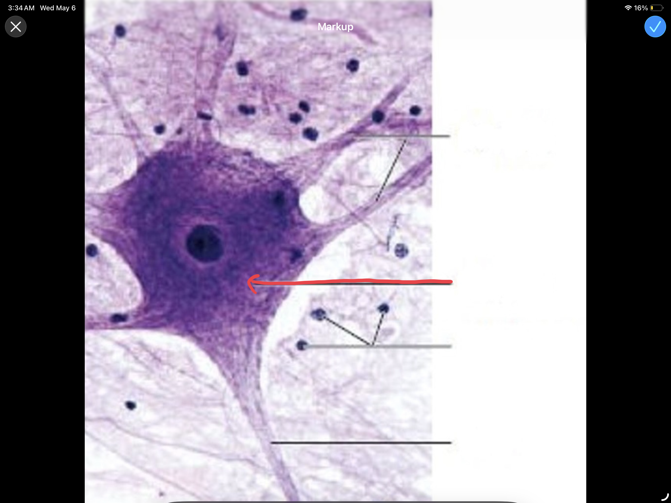 <p>Nerve cell body; houses nucleus and other important organelles.</p>