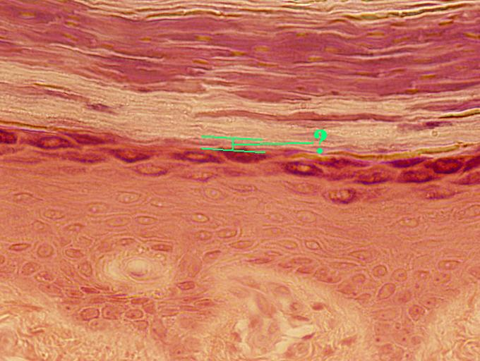 <p>Identify the indicated layer of thick skin</p>