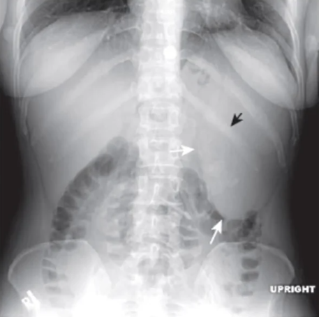 <p>diagnosis</p>