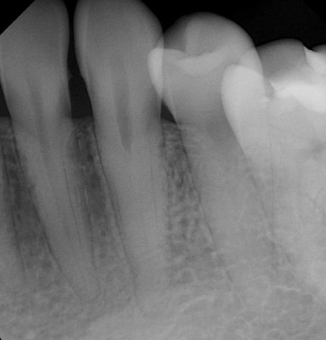 <p>How can you tell if you have a maxillary vs mandibular canine?</p>