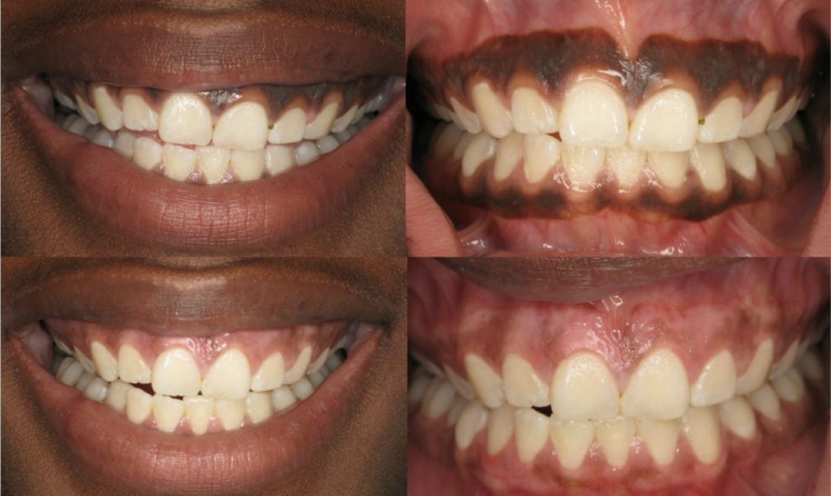 <p>What dental specialty is being displayed here?</p>