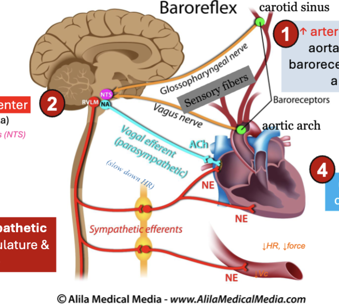 <p>rapid, short-term regulation of BP via negative feedback</p><p>steps when BP increases:</p><ol><li><p>INC of BP stretches arteries</p></li></ol><ul><li><p>baroreceptors in carotid sinus + aortic arch detect stretch</p></li><li><p>fire more AP</p></li></ul><ol start="2"><li><p>signals sent to cardiovascular center</p></li></ol><ul><li><p>medulla oblongata (nucleus tractus solitarius - NTS)</p></li></ul><ol start="3"><li><p>sympathetic activity DEC</p></li></ol><ul><li><p>DEC vasoconstriction</p></li><li><p>DEC heart activity</p></li></ul><ol start="4"><li><p>parasympathetic (vagal) activity INC</p></li></ol><ul><li><p>DEC heart rate</p></li><li><p>DEC contractility</p></li></ul><p></p><p>BP dec back toward normal</p>