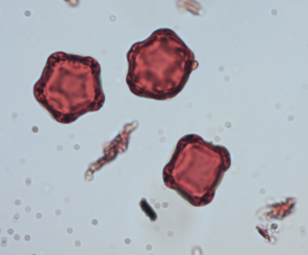 <p>Identify the pollen grains to the <strong>Family</strong> and <strong>Genus</strong></p>
