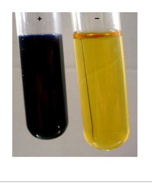 <p>What is this test testing for?</p>