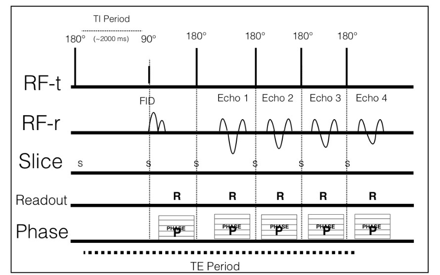 <p>FLAIR timing diagram</p>