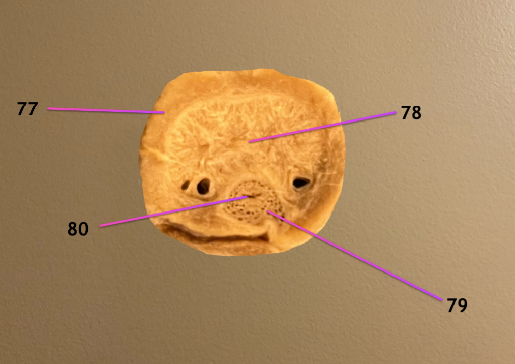 <p>cross section of body of penis</p><p>.</p><p>label 77-80</p>