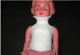 <p><span>upper dorsal; cervical spine</span></p>