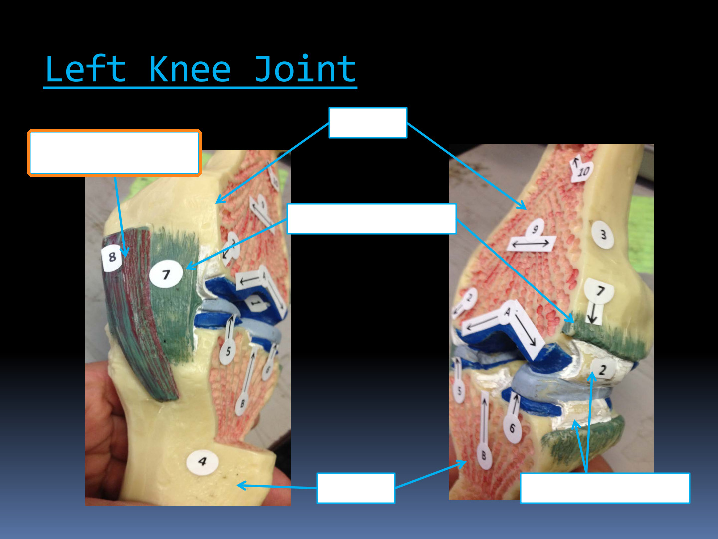 <p>Identify the highlighted structure in the Left Knee Joint: Ligaments and Capsule diagram.</p>