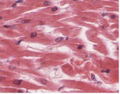 <p>muscle tissue</p>