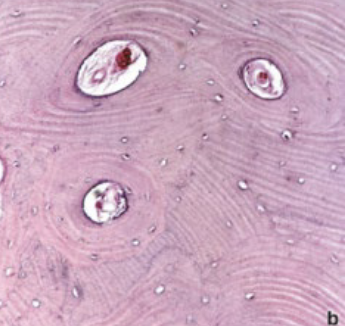 <p>ID the bone type</p>