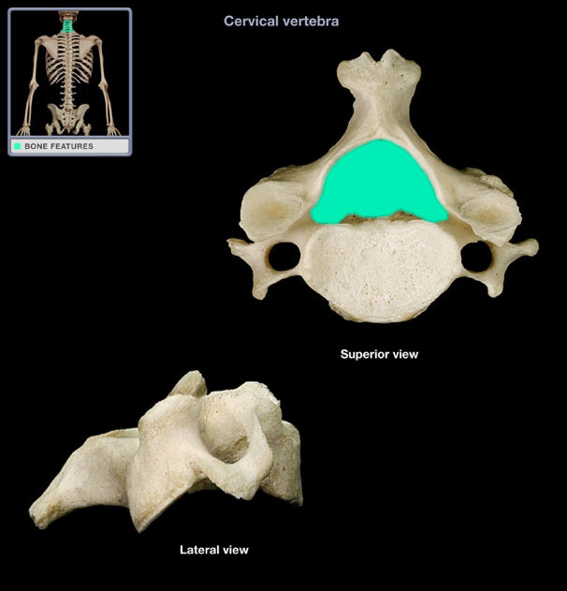 <p>(name of the vertebra part)</p>