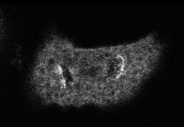 <ul><li><p>Nuclear membrane &amp; lamina break down </p></li><li><p>Nuclear pore complexes (NPCs) break down into subcomplexes</p></li><li><p>Mitotic spindle forms </p></li><li><p>Chromosomes segregate (karyokinesis) → nucleus reassembles around DNA </p><ul><li><p>Nuclear proteins re-recruited to nucleus through NLS </p></li><li><p>Unclear how NPC reassembles </p></li></ul></li><li><p>Cell membrane &amp; cytoplasm divides (Cytokinesis)</p></li></ul><p></p>