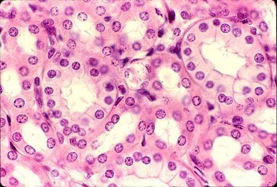 <p>cube shaped cells</p>