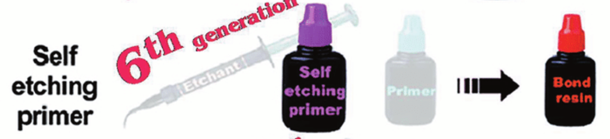 <ul><li><p><strong>2 steps </strong></p></li></ul><ol><li><p>self-etch primer</p></li><li><p>adhesive resin</p></li></ol><p></p>