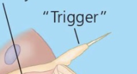 <p>Cnidocil “Trigger”</p>